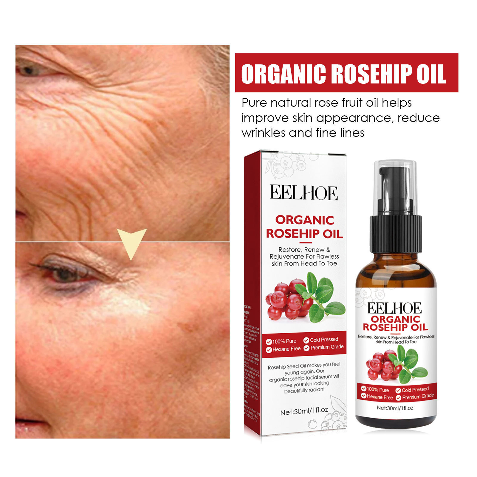 30ml 로즈힙 오일 페이셜 세럼 모이스춰 라이징 및  - Face Oil Rosehip 리뷰 및 가격